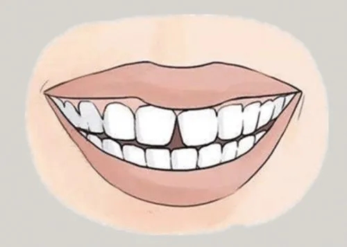 <a href=http://www.ldijz.cn/news_article?news_id=116>一次性口腔探針</a>